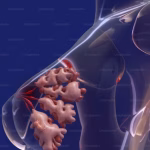 Rani znakovi na dojkama koje bi svaka žena starija od 60 godina trebalo da prepozna