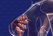 Rani znakovi na dojkama koje bi svaka žena starija od 60 godina trebalo da prepozna